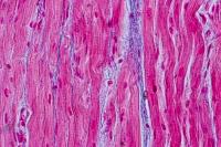 long muscle cells in the heart, as seen through a microscope